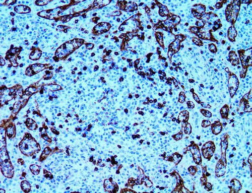 IHC of CD8 on an FFPE Tonsil Tissue
